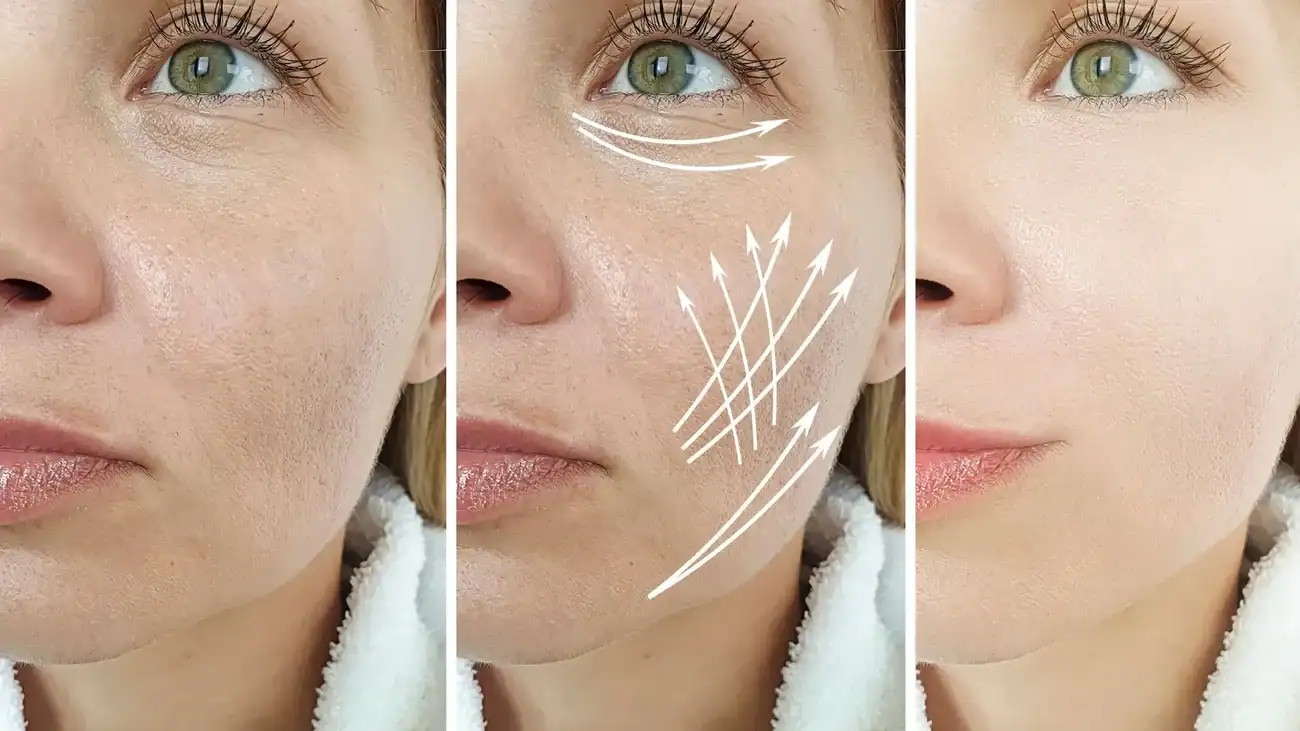 Can One Treatment Really Tackle More Than One Skin Concern Cumbernauld?