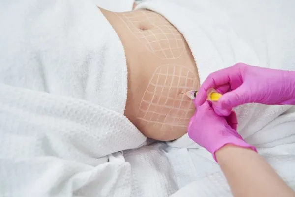 image of fat dissolving injections on love handles to help combat weight gain Cumbernauld