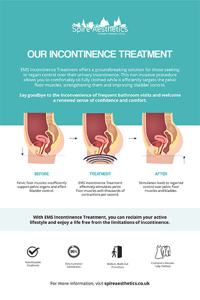 image to show how EMS treatment works for female urinary incontinence Cumbernauld