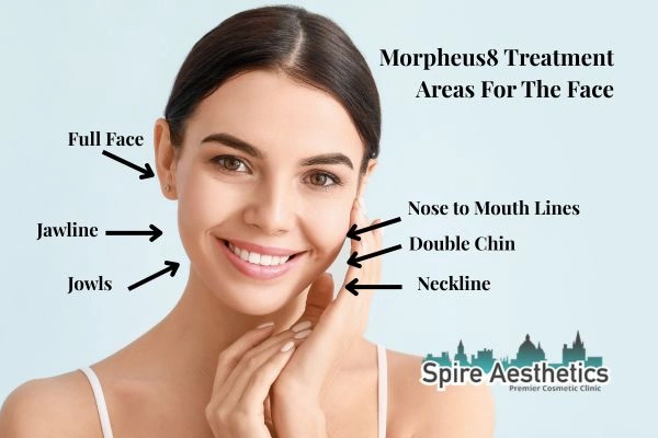 Where can Morpheus8 Treatment Cumbernauld be done on the body?